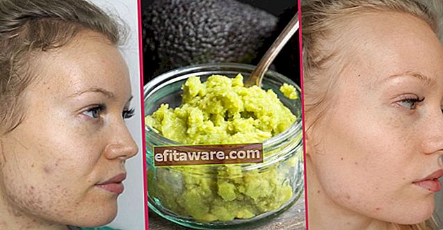 Două ingrediente simple sunt suficiente: mască anti-acnee și îmbătrânire de casă pentru avocado